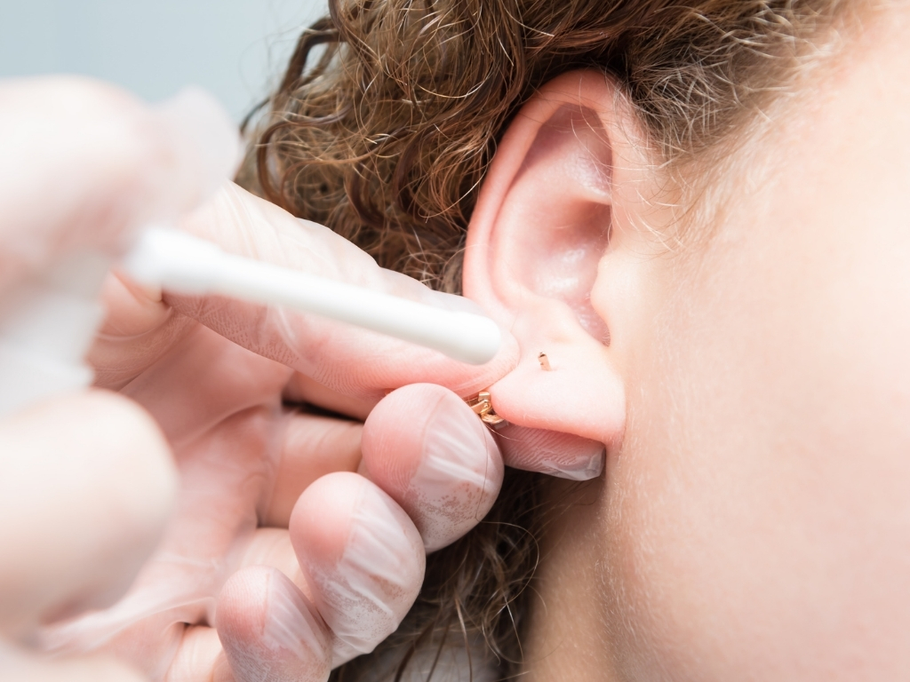 Imagen tratamiento Perforación del lóbulo de la oreja